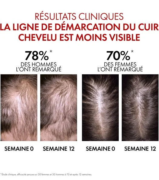 VICHY DERCOS AMINEXIL CLINICAL 5 FEMMES - Soin Anti-chute